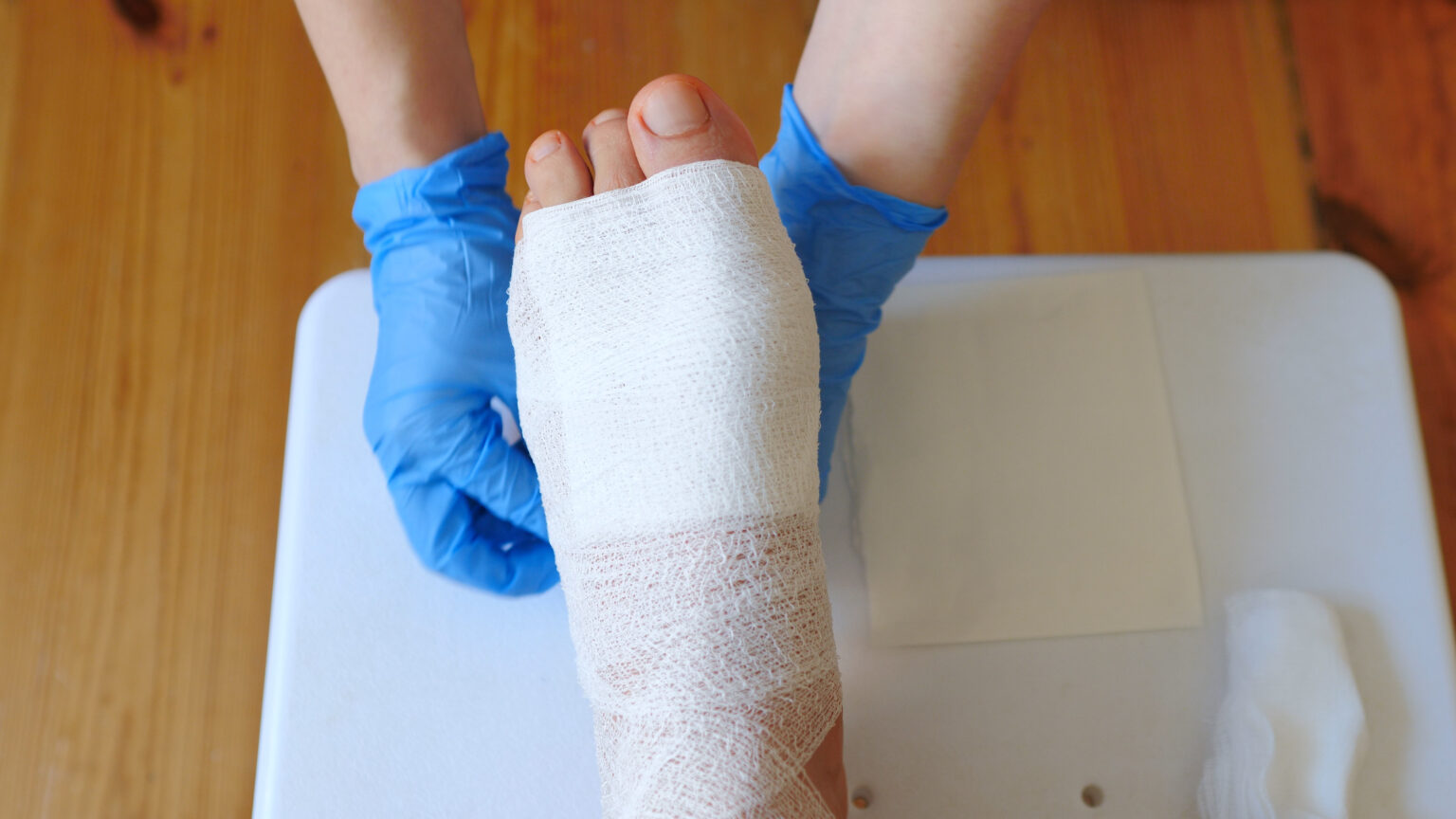 Simple dressings Calgary Foot Care Nurses